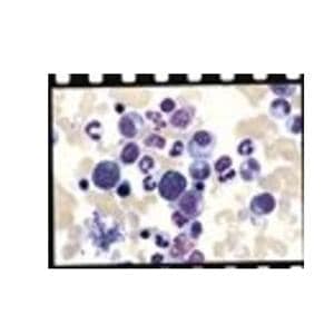 Richard-Allan Scientific Wright-Giemsa Stain Buffered 32oz 1/Bt