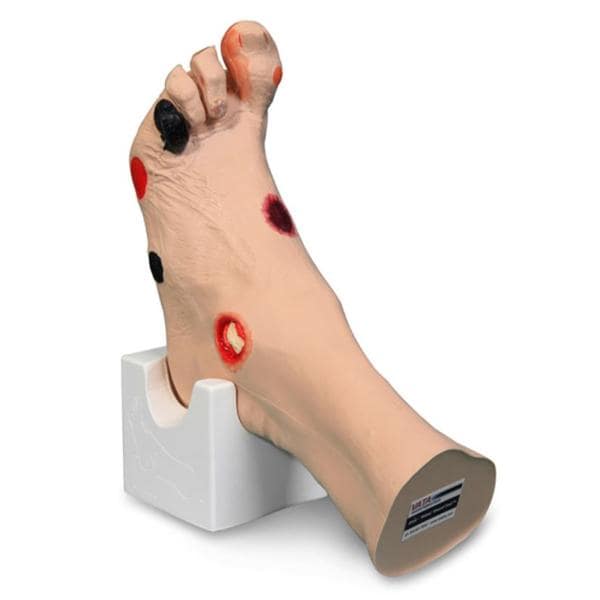 Wilma Wound Foot Anatomical Model Ea