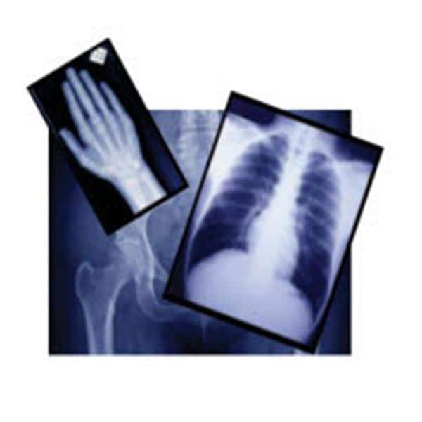 Clear Choice Performance X-Ray Film For Blue Rare Earth Screens 100/Bx