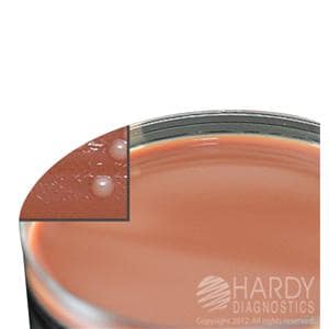 Neisseria Gonorrhoeae Test 10/Pk