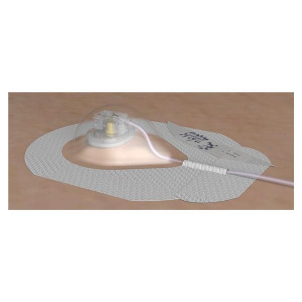 AllPoints Port Access Kit