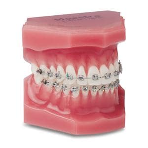 Maestro Mini-Twin MBT Rx Bracket .022 UL1 17T 4A 0O 10/Pk