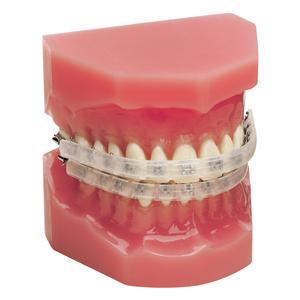 Ortho Organizers Lip Protector Ea