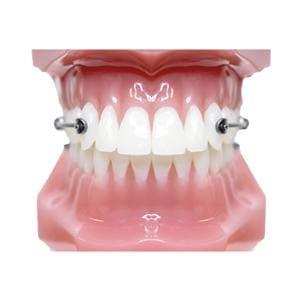 Carriere® Motion 3D™ Class II Typodont Ea