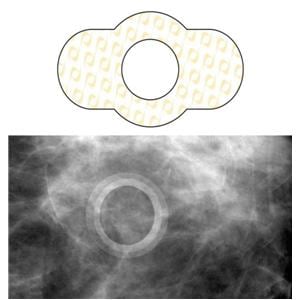 Spee-D-Ring Mole Marker 100/Bx