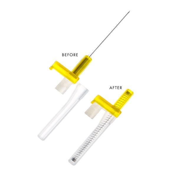 Hypodermic Needle 20gx1-1/2" Push Button 400/Ca