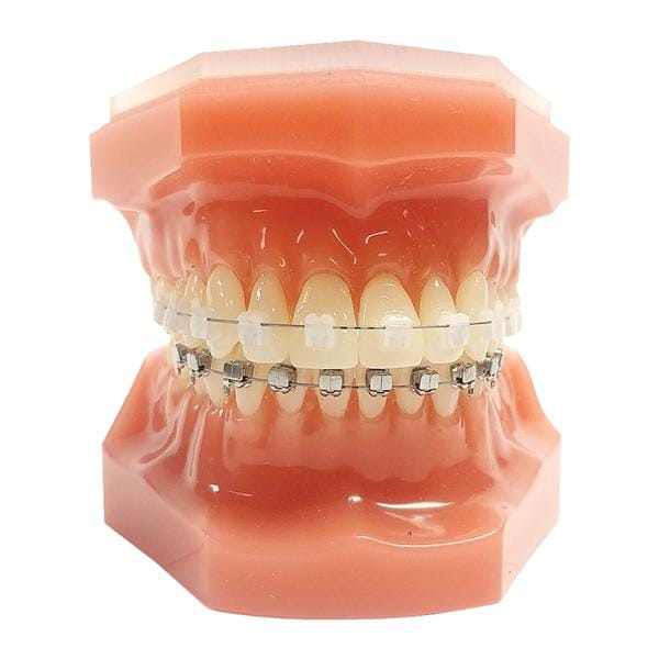 Carriere® SLX® 3D Typodont Ea