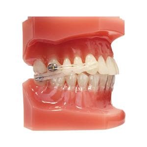 Carriere® Motion 3D™ CLEAR Class II Typodont Ea