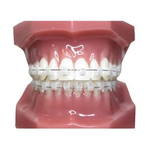 Carriere SLX Typodont Ea