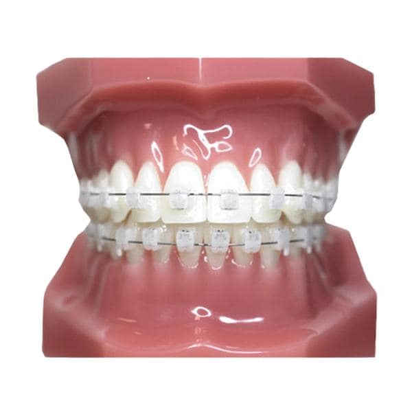 Carriere SLX Typodont Ea