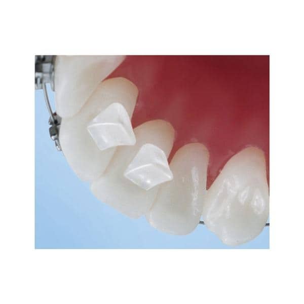 Bite-Builder Bondable Bite Opener Lingual 10/Pk