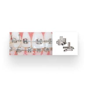 Crimpable Small Mini Stops Stainless Steel 50/Pk