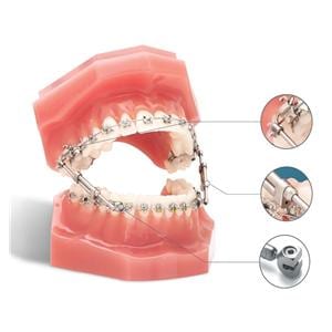 TruEase Bite Corrector 2/Pk