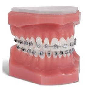 Pinnacle Bracket .018 in Upper Left 10/Pk