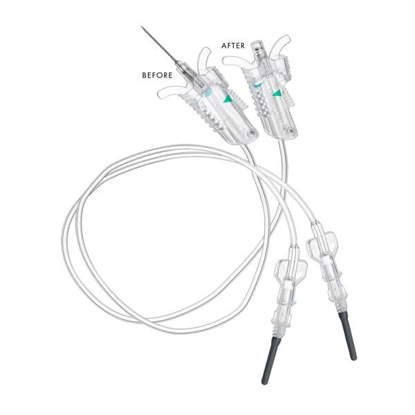 VanishPoint Blood Collection Set 21gx3/4" Winged 7" Safety 200/Ca