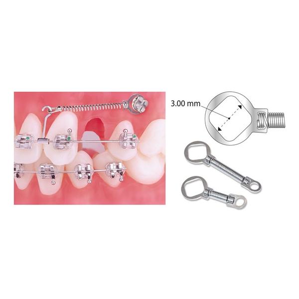 TruFlex Closed TAD Coil Spring Light Force NiTi 12 mm 0.009 in x 0.030 in 10/Pk