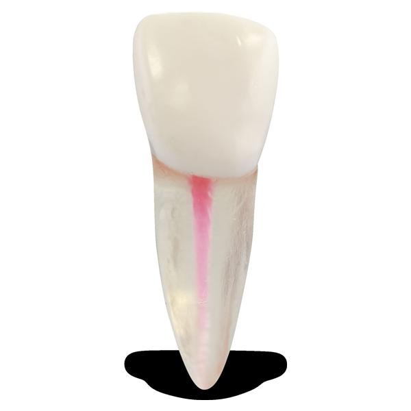 Real-T #8/Central Incisor/Maxillary Right Endo/Practice Tooth Ea