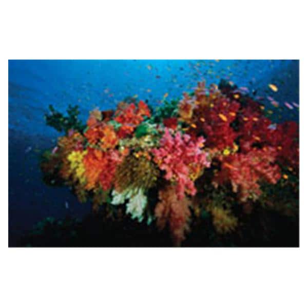 CeilingScenes Acoustic Tile Coral Reef 1-Tile Horizontal 48 in x 24 in Ea