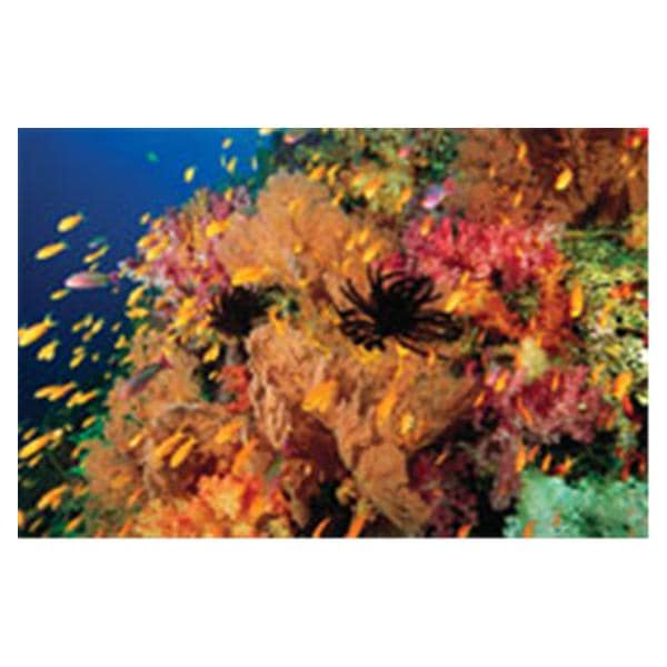 CeilingScenes Acoustic Tile Anties Fish 2-Tiles Horizontal 24 in x 24 in Ea