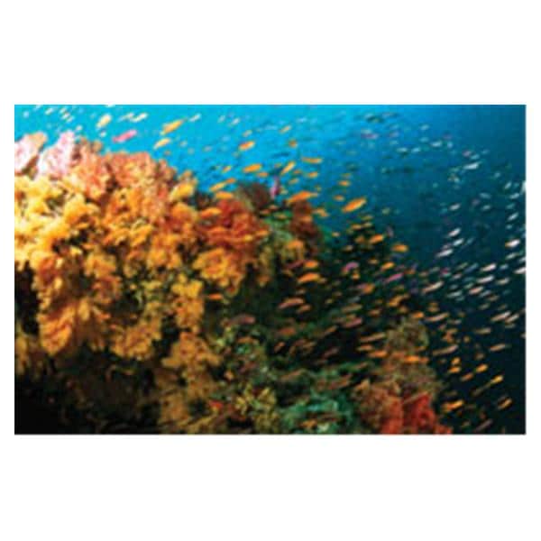 CeilingScenes Acoustic Tile Fiji Reef 2-Tiles Vertical 24 in x 48 in Ea