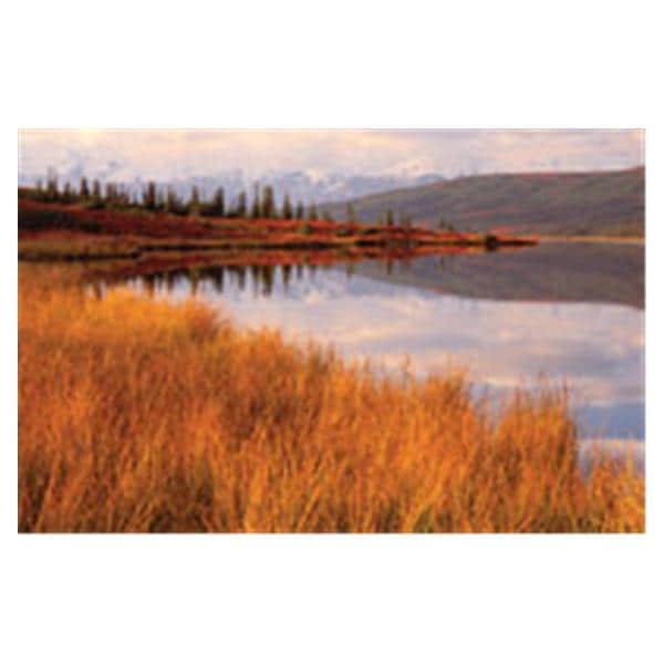CeilingScenes Acoustic Tile Wonder Lake 2-Tiles Vertical 24 in x 48 in Ea