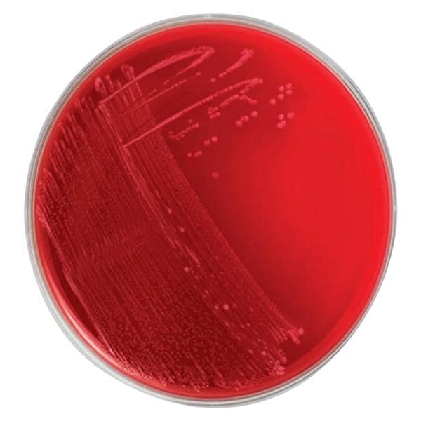 Anaerobic Blood Agar Culture Plate 10/Pk