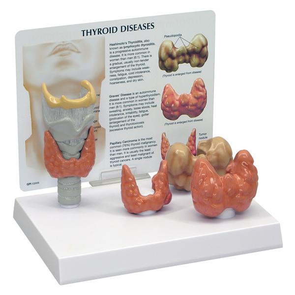 3B Scientific Thyroid Disease Training Model Ea