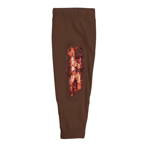 STOPS Medical Radial/Ulna Fracture Leg Sleeve Ea