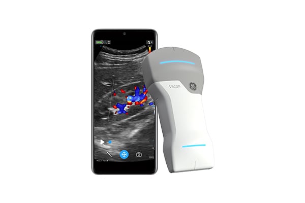 Portable Handheld Ultrasound: Vscan Air&trade; Ultrasound Machine