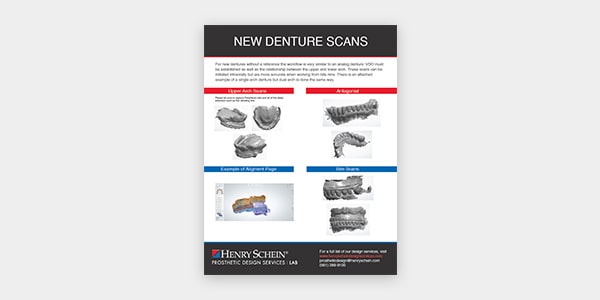 New Denture Scans