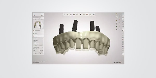 Dental System Crown & Bridge